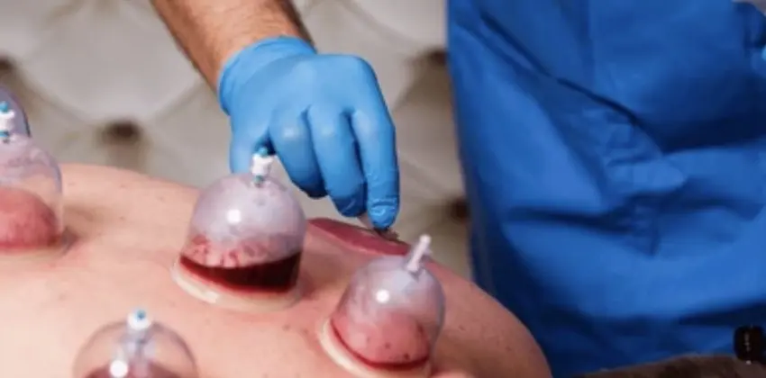 Hijama-Institut