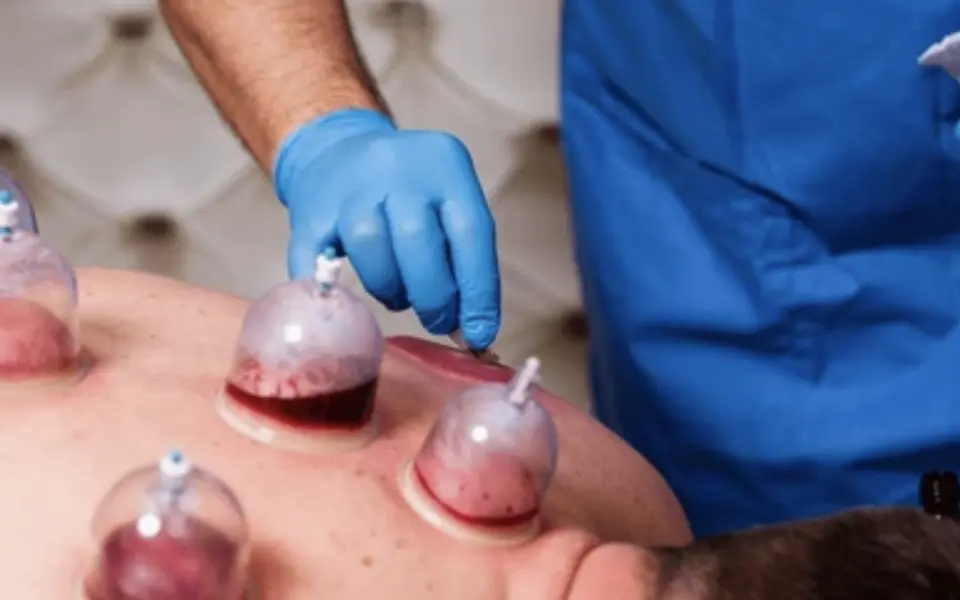 Hijama-Institut